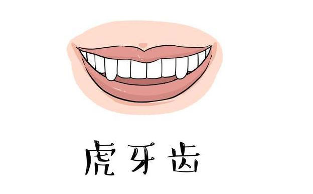 虎牙矯正需要多久？