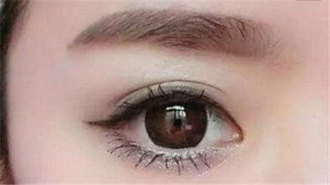 切眉手術(shù)要多長時間恢復？