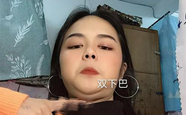 吸脂去雙下巴和溶脂瘦下巴有什么區(qū)別？