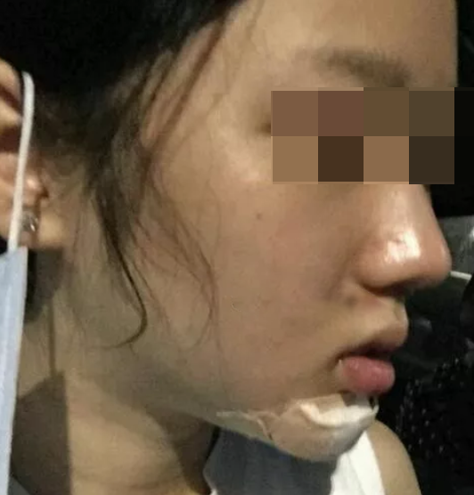 輪廓立體，更自信
