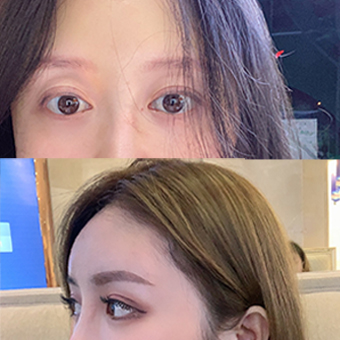 單眼皮睫毛
