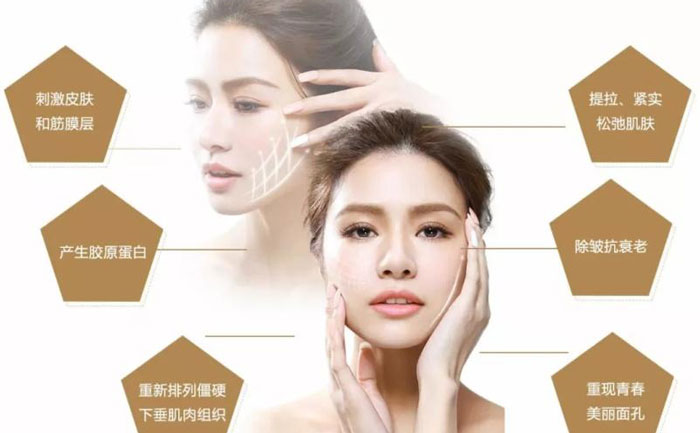 微整形面部提升價格多少？微整形面部提升能保持多久？