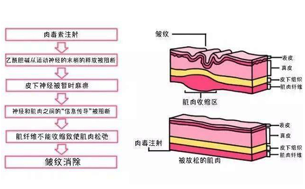 眼部皺紋的形成原因是什么?眼部除皺有什么方法?