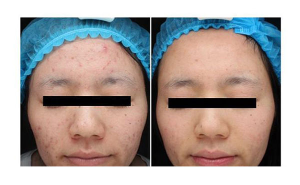 復合彩光安全嗎？