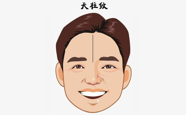 硅膠填充額頭安全嗎？