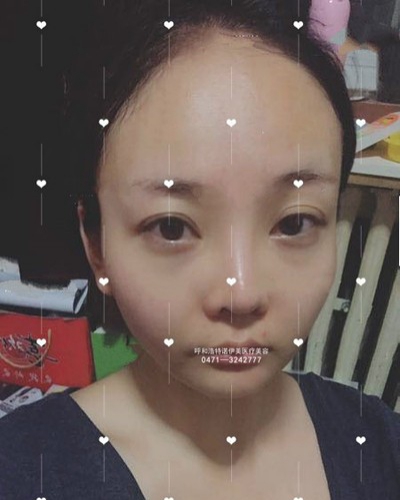 面部輪廓