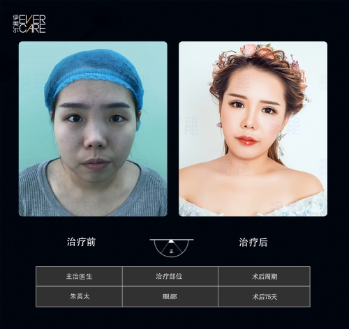 醫(yī)美整容