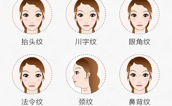 botox除皺針有哪些副作用？