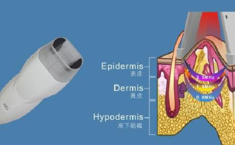 射頻除皺的效果好嗎？