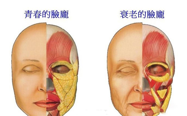 電波拉皮的誤區(qū)？