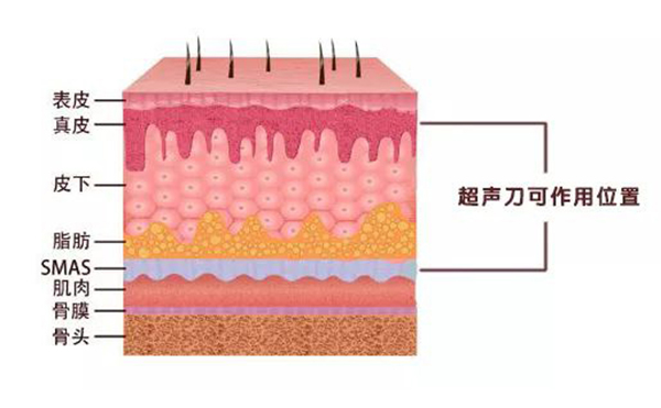 超聲刀有什么副作用?后果嚴(yán)重嗎?