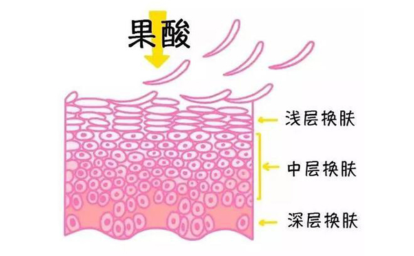 果酸煥膚的作用有哪些？