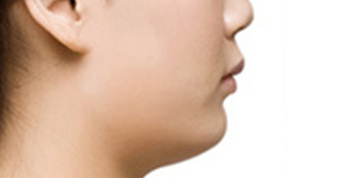 下巴截骨術(shù)術(shù)前