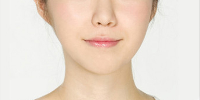 面部不對(duì)稱矯正術(shù)后