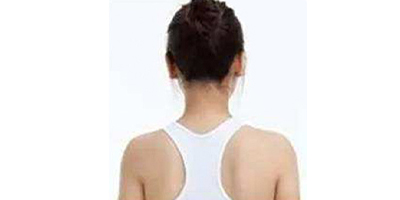 超聲溶脂瘦肩部術后