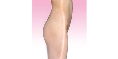 自體脂肪豐臀術后