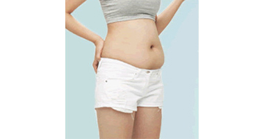 腰腹吸脂術(shù)前