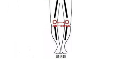 膝內(nèi)翻矯正術(shù)前