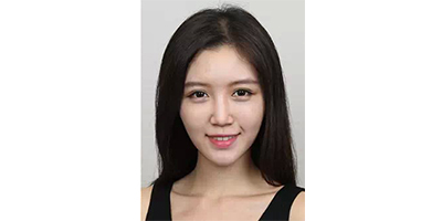 玻尿酸豐蘋(píng)果肌術(shù)后