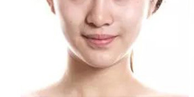 種植面膜術(shù)前