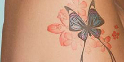 激光去紋身術(shù)前