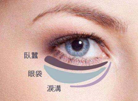 眼袋失敗修復(fù)要怎么處理？切眼袋需要多長(zhǎng)時(shí)間恢復(fù)？