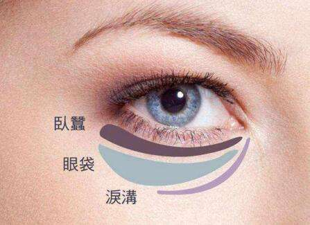 眼袋失敗修復(fù)要怎么處理？切眼袋需要多長(zhǎng)時(shí)間恢復(fù)？