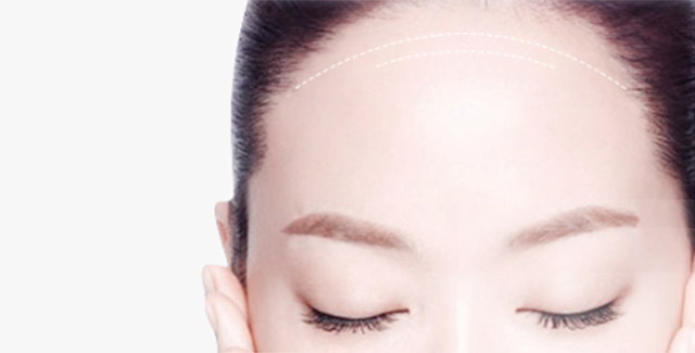 自體脂肪豐額頭效果怎么樣？自體脂肪豐額頭效果可以保持多久？