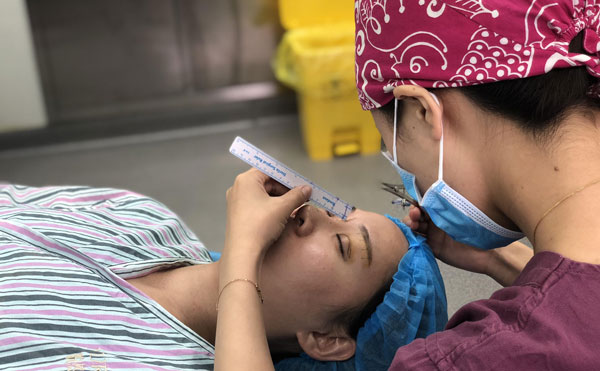 超體隆鼻怎么樣，能保持多久？超體隆鼻可能出現(xiàn)的副作用有哪些？