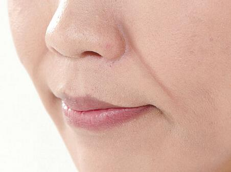 注射填充法令紋的方式有哪些？如何通過醫(yī)美手段祛法令紋？