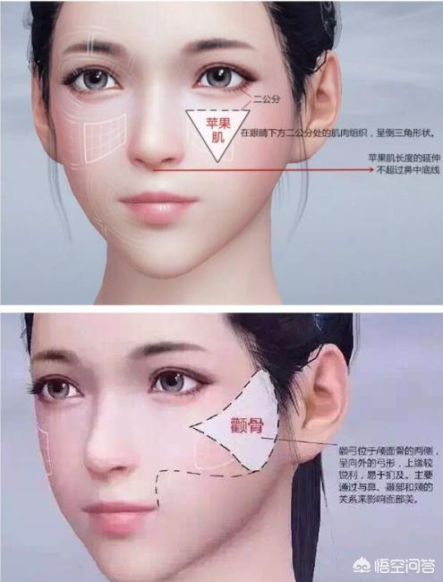 玻尿酸填充蘋果肌后效果能保持多久？想豐蘋果肌是自體好一點還是玻尿酸好一點？