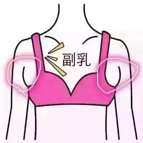 吸脂做副乳要多少錢(qián)？吸脂去副乳會(huì)反彈嗎？
