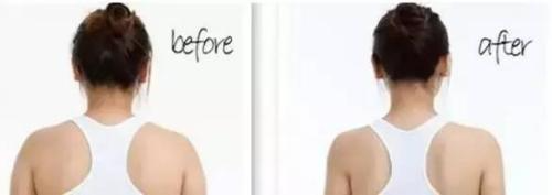 冷凍溶脂可以瘦肩膀嗎 冷凍溶脂瘦肩膀適應癥狀是什么