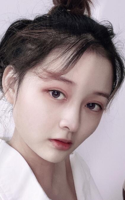 上海藝星醫(yī)療美容醫(yī)院做隆鼻手術(shù)的最終效果