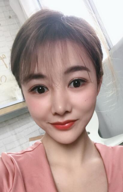 廈門華美名媛整形美容醫(yī)院做雙眼皮手術(shù)后的明亮雙眼