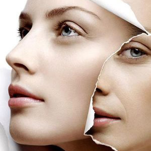 OPT嫩膚有什么功效  OPT嫩膚需要注意的事項(xiàng)