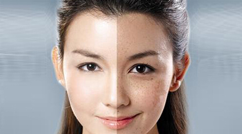 鐳射凈膚的原理功效 ？鐳射凈膚和m22是一種東西嗎？