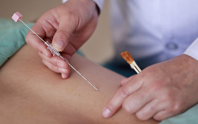 埋線減肥多少錢一次？埋線減肥多久才能有效果？