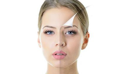 激光祛斑利弊是什么  激光祛斑吃什么有助于恢復