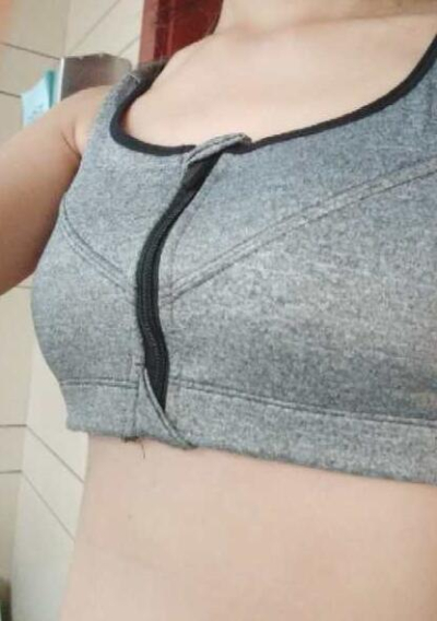 上海美萊醫(yī)療美容門診部做隆胸手術(shù)后一個(gè)月的情況