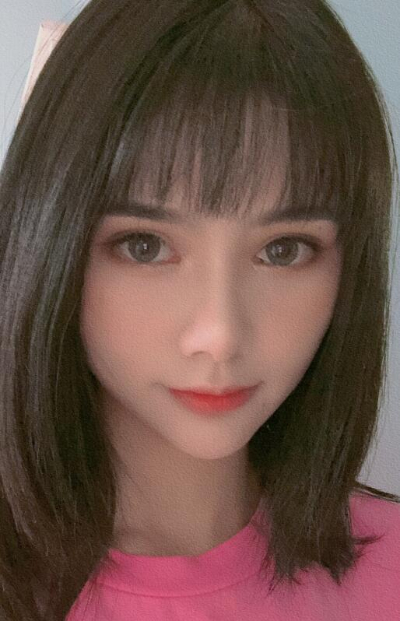 長(zhǎng)春亞韓醫(yī)學(xué)美容醫(yī)院做面部吸脂手術(shù)小臉的最終效果