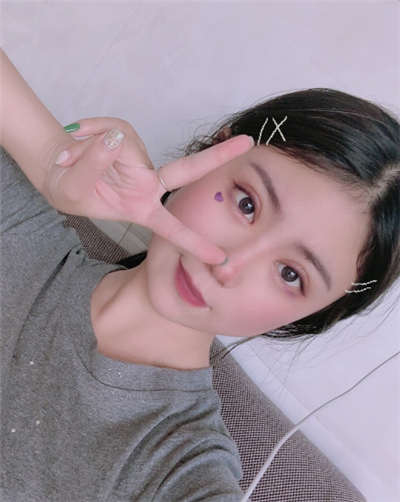 溫州友好醫(yī)院整形美容中心做雙眼皮手術(shù)的一周后