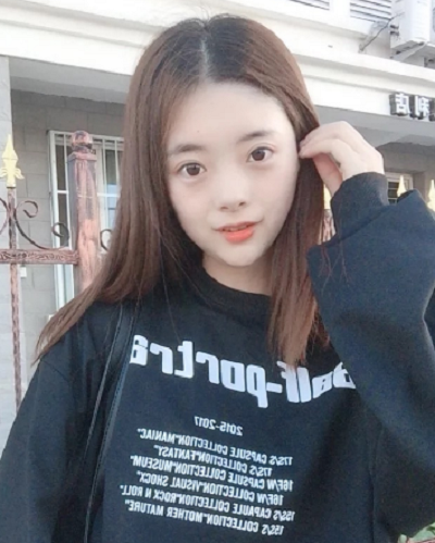 安徽韓美整形美容醫(yī)院做雙眼皮手術(shù)后的一個(gè)月