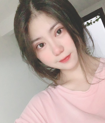 溫州友好醫(yī)院整形美容中心做雙眼皮手術(shù)10天后