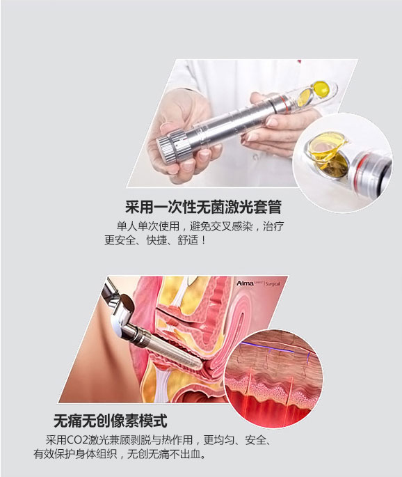 成都愛爾麗整形激光緊縮陰道怎么樣？激光緊縮陰道注意什么？