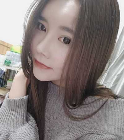 上海藝星醫(yī)療美容醫(yī)院做顴骨降低手術(shù)后的最終狀態(tài)