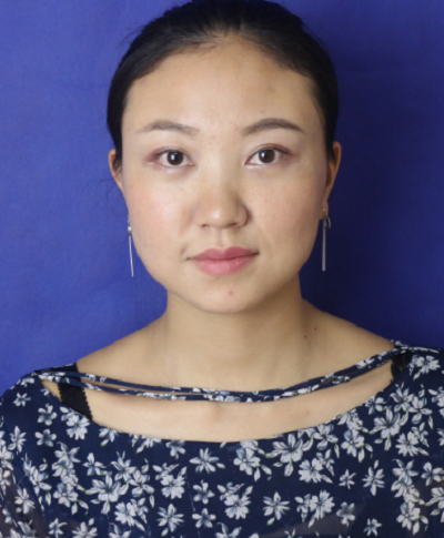 蘇州同濟醫(yī)院整形美容中心做去眼袋手術(shù)后的最終效果