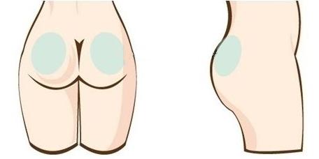 成都大華韓藝做臀部吸脂減肥安全性如何有什么特點(diǎn)？