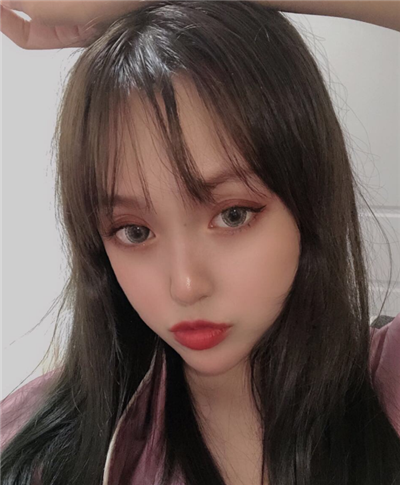 慈溪悅爾醫(yī)學(xué)美容醫(yī)院做雙眼皮術(shù)后基本消腫情況