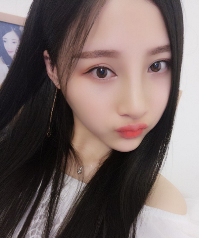 鄭州麗天整形美容醫(yī)院做面部吸脂手術(shù)后的最終狀態(tài)